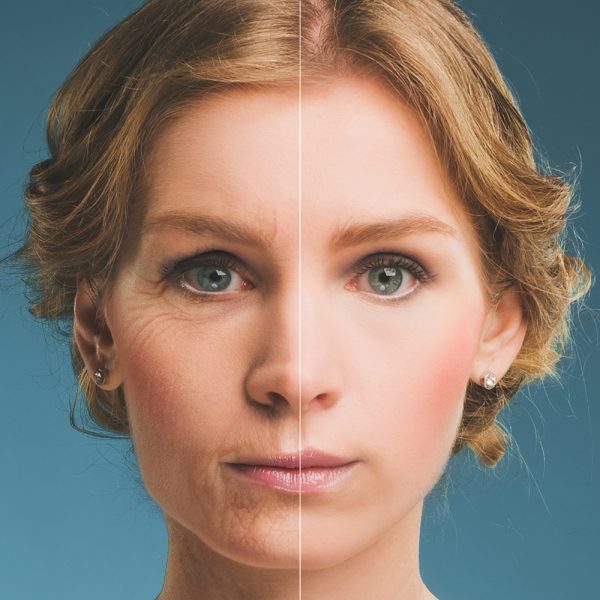 A woman 's face is shown before and after surgery.