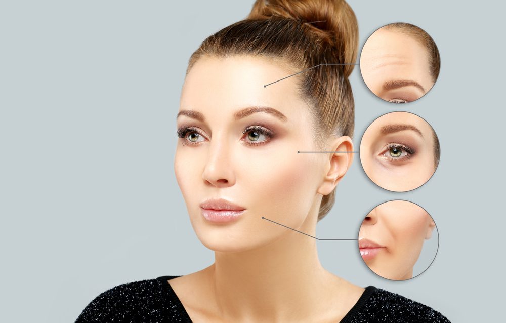 A woman with various facial features and the stages of botox.