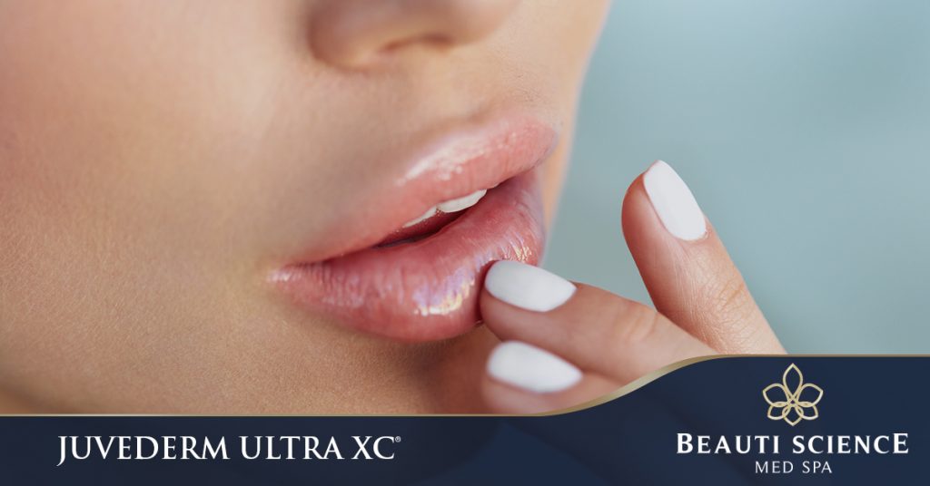 Juvéderm Ultra Xc Lip Filler Treatment In Plano Beauti Science Med Spa 7467