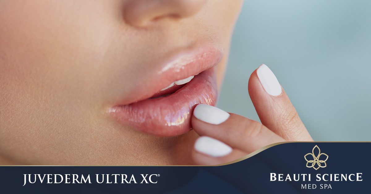 Juvederm Ultra XC Cosmetic Lip Filler in Plano